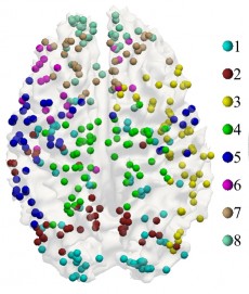 human brain with colored plot points.