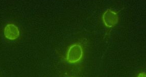 immunofluorescence image 