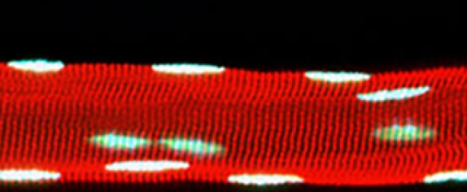 microscope image of red band with white spots